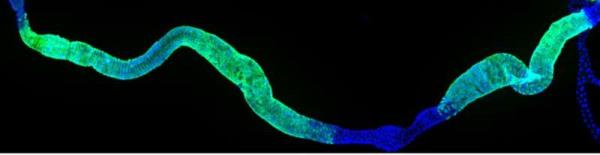 How the gut finishes healing itself