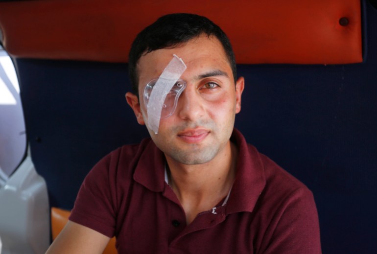 Saeed Imran, 23, has shrapnel stuck inside his right eye