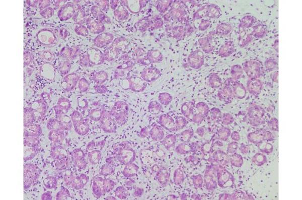 Researchers discover a molecule that helps pancreas cell mature and limits tumour formation