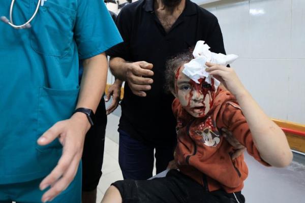 An injured girl holds a handkerchief to her head at the Al-Nasr hospital, following Israeli bombardment in Khan Yunis in the southern Gaza Strip on Oct. 26 amid the o<em></em>ngoing battles between Israel and Hamas.